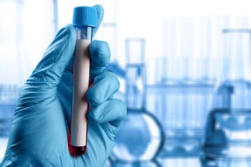 Omicron Variant on test tube, Covid 19 concept