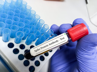 Scientist hold blood sample for COVID-19 spike protein test, COVID-19 IgG antibody test, after vaccination, tips holder with tips background