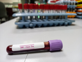 Blood sample tube for RBC Folate test. To measures the amount of folate in the blood. Folic acid....