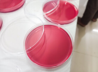 MacConkey agar media, pink agar culture media, used to differentiate lactose and non lactose...