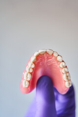 Vertical shot of doctor holding prosthetic teeth in hand. Upper view of teeth and palate over gray background