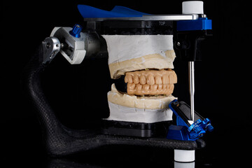 prostheses for trying on the upper and lower jaws in a professional articulator on a black...