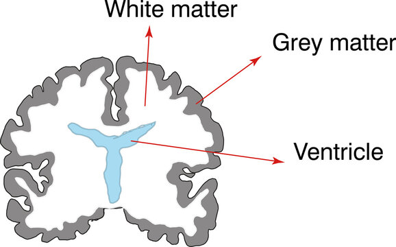 brain cross section