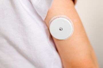 CGM -system of continuous monitoring of glucose on child's arm.