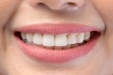 Close up of white healthy teeth of beautiful smile young woman
