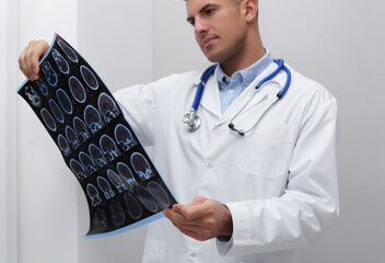 Doctor examining MRI images of patient with multiple sclerosis in clinic