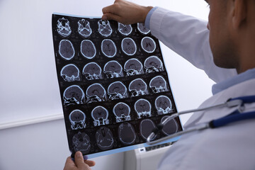 Doctor examining MRI images of patient with multiple sclerosis in clinic, closeup