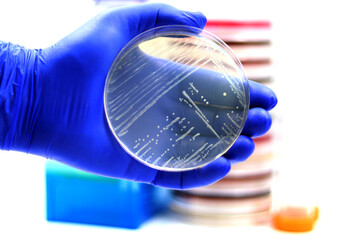 The human pathogenic bacterium Listeria monocytogenes growing in a plate of Luria agar