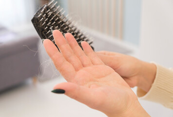 Female hands clean.Lots of fallen hair on a comb. Hair loss problem, hormonal failure, stress, diet