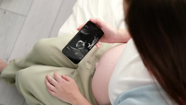 Top view cropped of pregnant woman looking ultrasound video on phone of fetus standing at home, young future mom waiting child first baby, pregnancy and motherhood concept