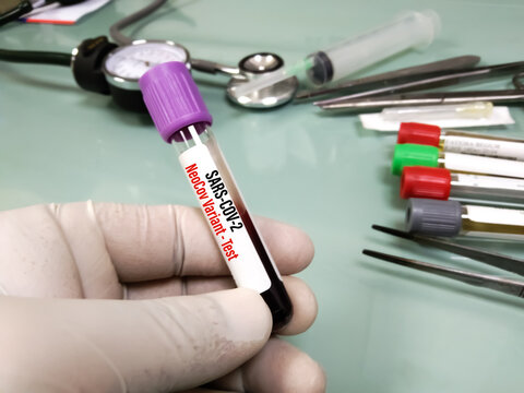 Blood Sample Tube For SARS-COV-2, Covid-19 New Variant NeoCov Test. Wuhan Scientists Warn Of New Type Of Coronavirus With High Death, Infection Rate