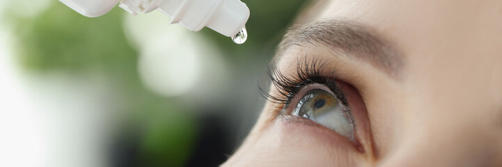 Woman drips eye drops into eye for allergies closeup - obrazy, fototapety, plakaty