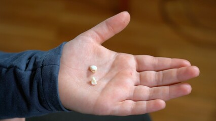 7 year old children boy shows two milk teeth with a recently fallen tooth ( losing a tooth )  in his hand  - dental care in childhood