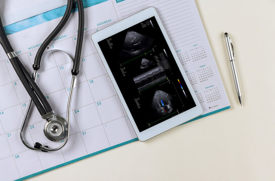 Doctor medical worktable with stethoscope on research in ultrasound 3d cardiac examination of the patient on digital table - Powered by Adobe