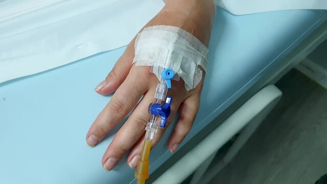 Cannula and catheter needle inserted and taped on patients hand to deliver IV intravenous fluids for a women receiving receiving treatment in hospital clinic