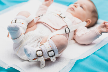 A baby wearing a harness that corrects hip dysplasia