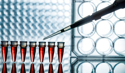 PCR microtubes and pipette in the genetic laboratory on the background of the tablets