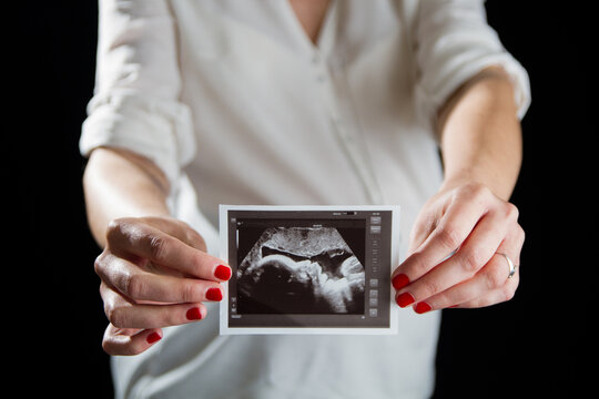Future maman pr&eacute;sentant la radio de son b&eacute;b&eacute;