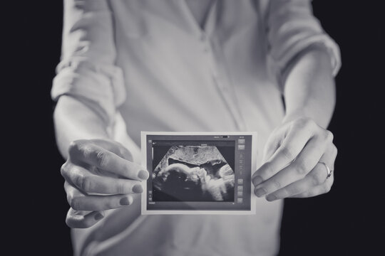 Future maman pr&eacute;sentant la radio de son b&eacute;b&eacute; noir et blanc
