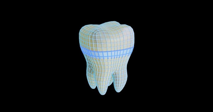 3d animation lightening of tooth enamel in stages. hi-fi mesh surrounds molar stain, caries, treatment, restoration, whitening, plaque removal, protection