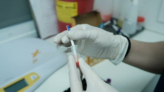 A close-up of hands, wearing latex gloves, holding a test tube with litmus test kit in the laboratory.