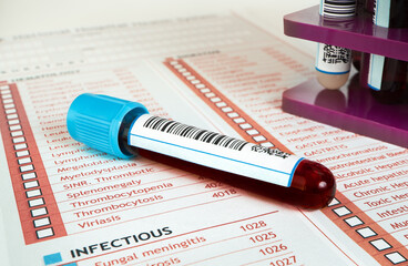 Blood tube test and medical report. Blood sample tube in the hematology laboratory