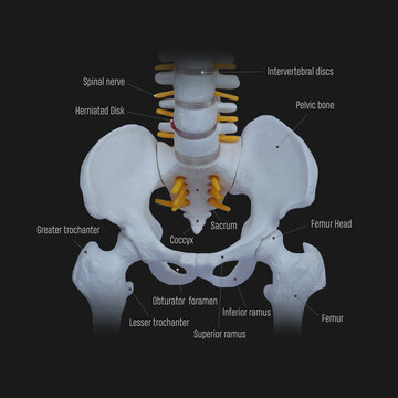 Pelvis Bone anatomy. Sacrum, Ischium, pubis and ilium. Human skeleton, medicine.Herniated Disk