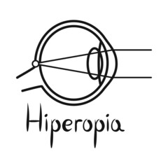 Vector illustration of hyperopia and eyeball logo. Web element of hyperopia and eye stock vector illustration.