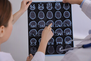 Doctors examining MRI images of patient with multiple sclerosis in clinic, closeup