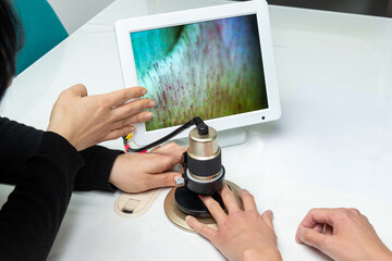 毛細血管血流スコープ　健康管理　健康診断　定期検診