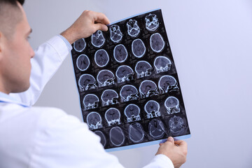 Doctor examining MRI images of patient with multiple sclerosis in clinic, closeup