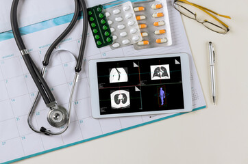 Medicall office report of MRI scan of the patient with stethoscope in showing in digital tablet and...