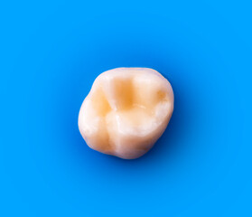 tooth restored by esthetic composite filling 
