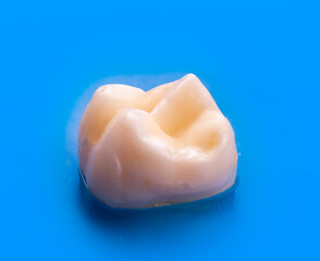 tooth restored by esthetic composite filling 