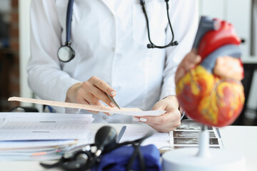 Doctor cardiologist examining cardiogram against background of artificial heart model closeup