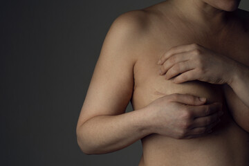 Breast cancer survivor woman show the scar on her chest following a mastectomy