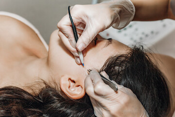 Female cosmetologist performs the procedure of permanent removal of unwanted facial hair by...