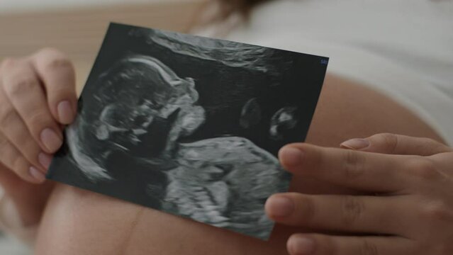 Pregnant woman shows an ultrasound photo of unborn baby to camera. Expectant mother holds in hands black and white image of an unborn child in womb