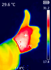 A thermographic image of a person's hand showing different temperatures in different colors, from...