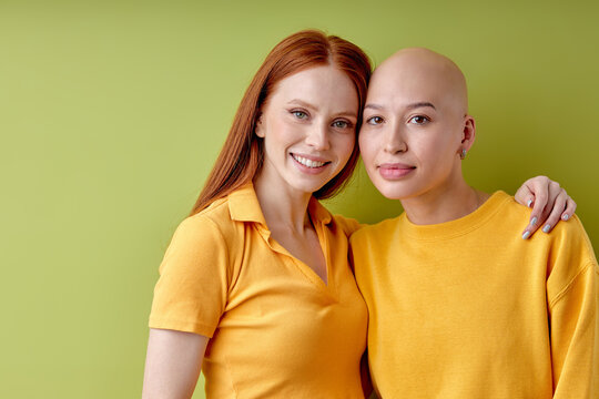 Two diverse european redhead and bald ladies models hugging isolated over green background, portrait of young females in casual yellow shirts having close friendship, enjoying life, smiling