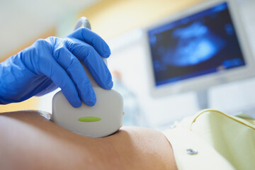 Fototapeta Badanie usg, ultrasonografia. Badanie brzucha, wątroby, trzustki, ciąży. obraz