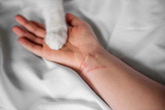 The paw of a white-red cat lies on a violently scratched male hand until it bleeds. Pet attack.