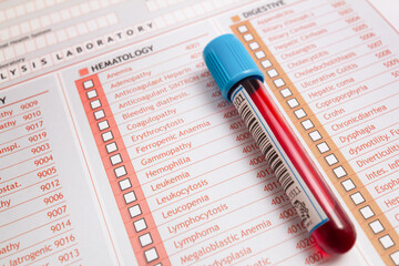 Blood sample and medical report for hematology test in the laboratory. Tube with blood from a sick patient for blood Checkup - obrazy, fototapety, plakaty