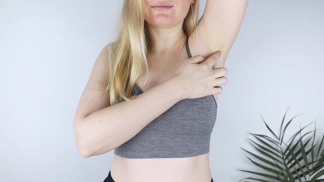 Close-up of a girl who smears cream on her armpit. Girl body care concept. Therapy for excessive sweating. Home treatment. Dry skin. Moisturizing with ointment.