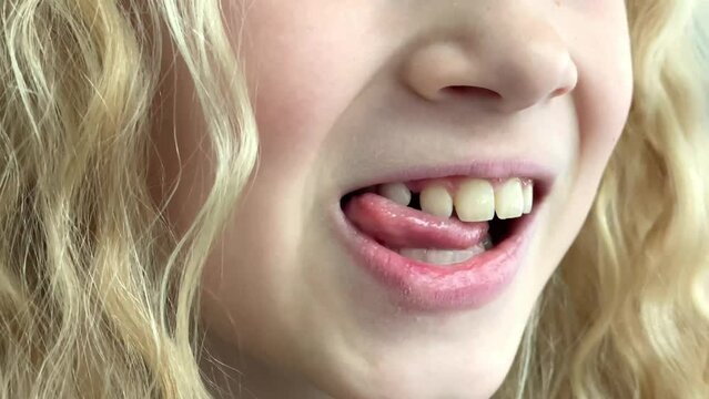 Blonde caucasian baby girl shaking tongue milk tooth in mouth, children dentistry stomatology and losing first premolar tooth