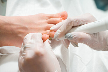A Podiatrist doctor who takes care of a woman's toenails. Cosmetic procedures of the feet