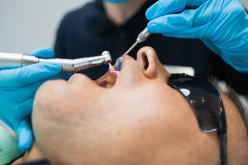 Dentist doing teeth cleaning procedure for male patient. Professional dental hygiene