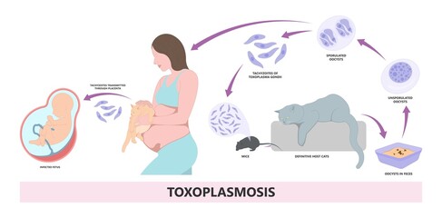 Toxoplasmosis cyst Fecal life cycle cat retina eye hiv aids mother child retina pet women animal faece poop fetal birth defect T. gondii poo meat pork virus fungi
