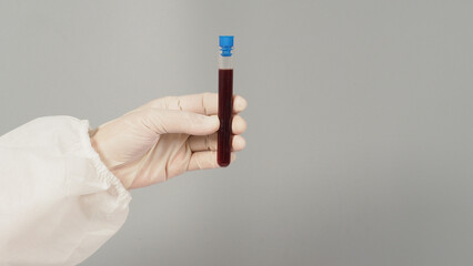 The hand is holding a blood test tube on grey background. Hand wears a PPE suit and a white medical...
