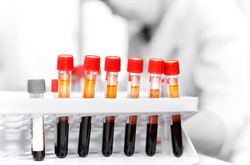 Test tubes with blood in color on the black and white background of the laboratory.